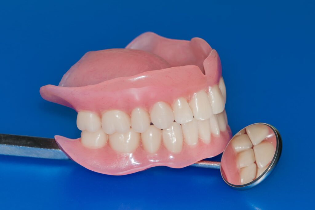 What Are the Benefits of Complete Dentures?